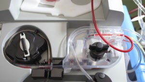 Modern hemodialysis machine after function